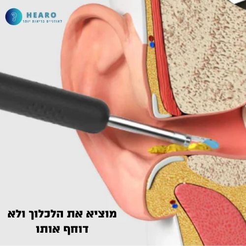 מנקה האוזניים עם המצלמה See&Clean של Hearo