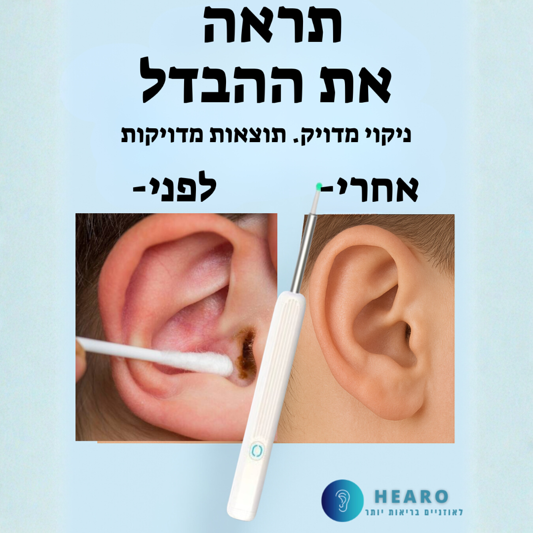 מנקה האוזניים עם המצלמה See&Clean  של Hearo